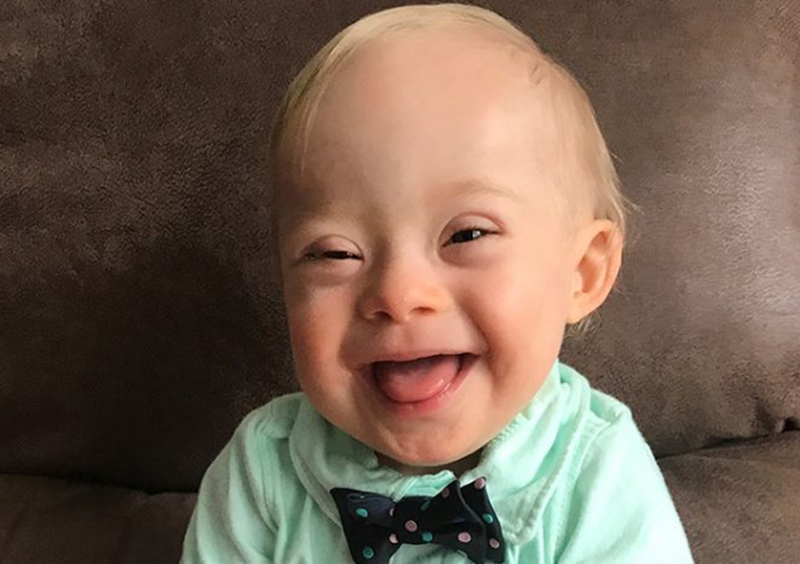 Un bebé con Síndrome de Down, nueva imagen de Gerber