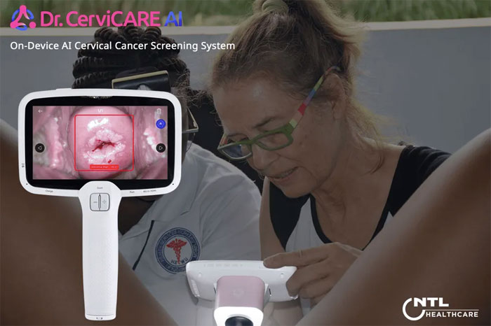 Dr.CerviCARE AI de NTL