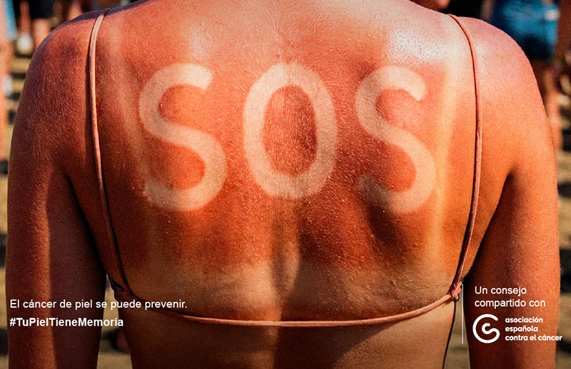 "Protégete del sol": Tu piel tiene memoria